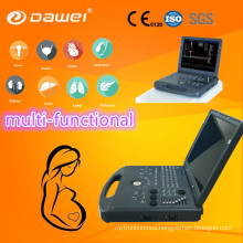 DW-C60 color doppler ultrasound system, color doppler ultrasound oem